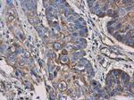 CD123 Antibody in Immunohistochemistry (Paraffin) (IHC (P))