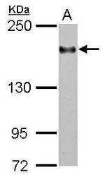 CD11a Antibody in Western Blot (WB)