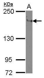 CD11a Antibody in Western Blot (WB)