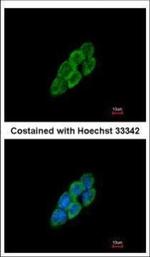 LTBP4 Polyclonal Antibody