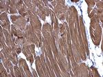 alpha-Cardiac Actin Polyclonal Antibody