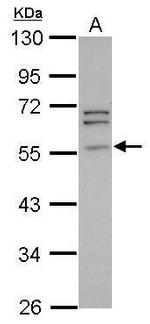 Peripherin Antibody in Western Blot (WB)