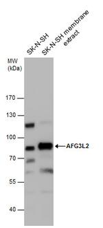 AFG3L2 Antibody in Western Blot (WB)