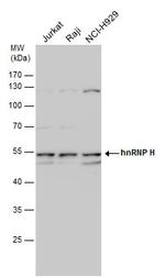 hnRNP H1 Antibody in Western Blot (WB)
