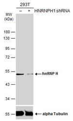 hnRNP H1 Polyclonal Antibody