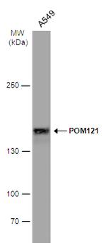 POM121 Antibody in Western Blot (WB)