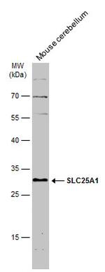 SLC25A1 Antibody in Western Blot (WB)