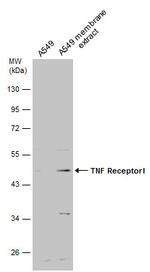TNFR1 Polyclonal Antibody