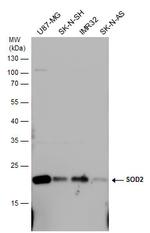 SOD2 Polyclonal Antibody