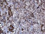 MMP10 Polyclonal Antibody