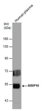 MMP10 Antibody in Western Blot (WB)