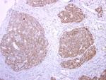 tPA Polyclonal Antibody