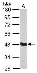 MAGE1 Antibody in Western Blot (WB)