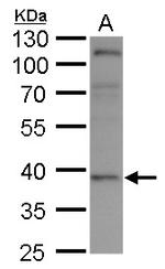 XRCC3 Antibody in Western Blot (WB)