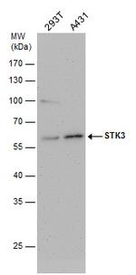 MST2 Antibody in Western Blot (WB)