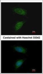 MMP2 Polyclonal Antibody