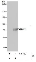 MMP2 Antibody in Immunoprecipitation (IP)