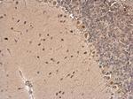 CSB Antibody in Immunohistochemistry (Paraffin) (IHC (P))