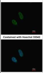 ATRIP Antibody in Immunocytochemistry (ICC/IF)