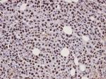 ATRIP Antibody in Immunohistochemistry (Paraffin) (IHC (P))