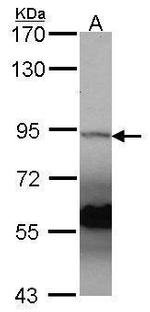 ATRIP Antibody in Western Blot (WB)