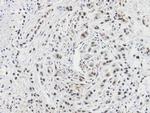 Calcyclin Antibody in Immunohistochemistry (Paraffin) (IHC (P))