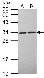 Calcyclin Antibody in Western Blot (WB)