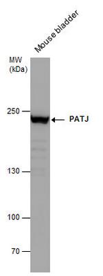 PATJ Polyclonal Antibody