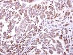 NKG2D Polyclonal Antibody