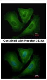 HLA-DRB3 Polyclonal Antibody