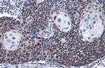 LOXL2 Antibody in Immunohistochemistry (Paraffin) (IHC (P))