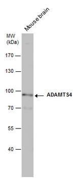 ADAMTS4 Polyclonal Antibody