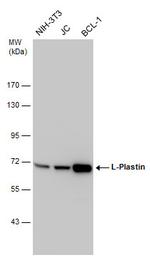 L-Plastin Antibody in Western Blot (WB)