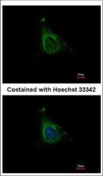 AKAP10 Polyclonal Antibody