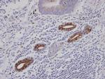 AKAP10 Antibody in Immunohistochemistry (Paraffin) (IHC (P))