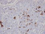 AKAP10 Antibody in Immunohistochemistry (Paraffin) (IHC (P))