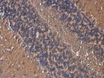 AKAP10 Antibody in Immunohistochemistry (Paraffin) (IHC (P))