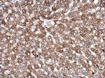 AKAP10 Antibody in Immunohistochemistry (Paraffin) (IHC (P))