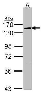 VCPIP1 Antibody in Western Blot (WB)