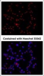 GOLPH2 Antibody in Immunocytochemistry (ICC/IF)