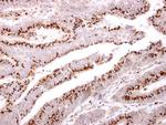 GOLPH2 Antibody in Immunohistochemistry (Paraffin) (IHC (P))