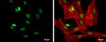 FOXP3 Antibody in Immunocytochemistry (ICC/IF)