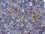 FOXP3 Antibody in Immunohistochemistry (Paraffin) (IHC (P))