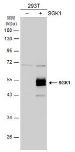 SGK1 Polyclonal Antibody