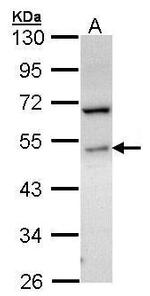 SPHK1 Antibody in Western Blot (WB)