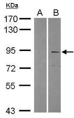 TRIM2 Polyclonal Antibody