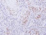 OPRM1 Polyclonal Antibody