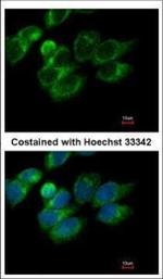 PRDX4 Polyclonal Antibody