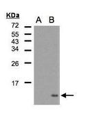 CCL5 (RANTES) Polyclonal Antibody