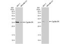 Cyclin D1 Antibody in Western Blot (WB)